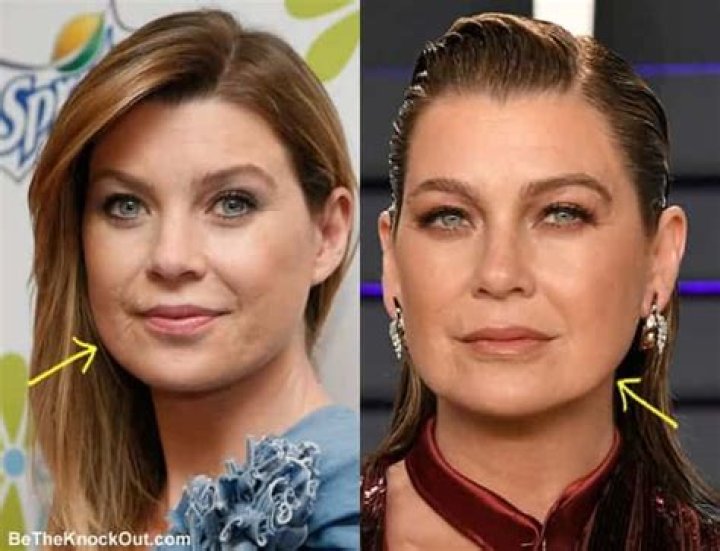 Ellen Pompeo Face Scar: The Story Behind the Mark and What You Need to Know